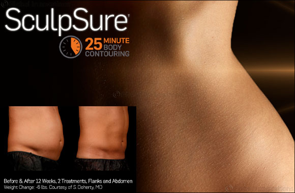 Incorporate SculpSure, the Non-Surgical Fat Treatment, Into Your Busy Schedule