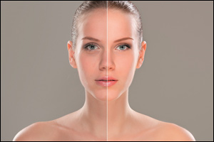 Rejuvenate your skin's vitality with VLCC's StemYouth treatment